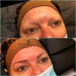 microblading phibrows