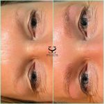 microblading